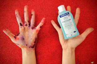 El concurso busca promover el lavado de manos entre los profesionales sanitarios.